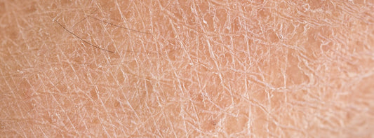 Is Your Shower Water Secretly Aging Your Skin? What Every Malaysian Should Know